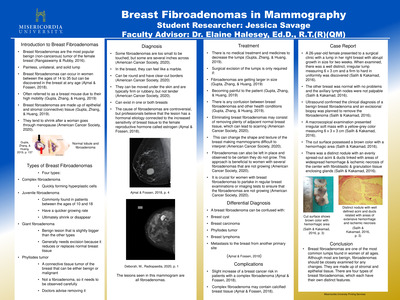 Breast Fibroadenomas by Jessica Savage