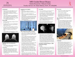 MRI-Guided Breast Biopsy