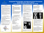 Computed Tomography and Adrenocortical Carcinoma