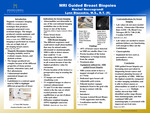 MRI Guided Breast Biopsy
