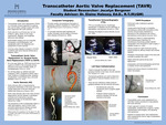 Transcatheter Aortic Valve Replacement (TAVR)