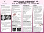 Detecting & Treating Ductal Carcinoma in Situ