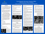 Fetal Magnetic Resonance Imaging (MRI) by Madison Woodhead
