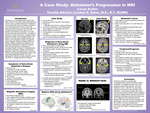 A Case Study: Alzheimer’s Progression in MRI
