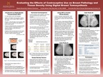 Evaluating the Effects of Contraceptive Use on Breast Pathology and Tissue Density Using Digital Breast Tomosynthesis