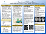 Functional MRI Brain Scan