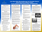 Low Dose Rate Brachytherapy for Prostate Cancer by Madelyn Heidlauf