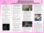 MRI-Guided Breast Biopsy by Madison Preste
