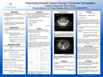 Diagnosing Ovarian Cancer Through Computed Tomography by Olivia Kempf