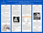 Computed Tomography Angiography: Transcatheter Aortic Valve Replacement by Dante Vitali