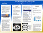 Low Dose Computed Tomography in Lung Cancer Diagnosis by Jocelyn M. King