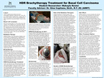 HDR Brachytherapy Treatment for Basal Cell Carcinoma​