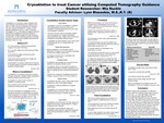 Cryoablation to Treat Cancer Utilizing Computed Tomography Guidance by Mia D. Ruckle