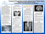 Computed Tomography: Contrast Induced Acute Kidney Injury by Keileen E. Trochez Tome