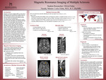 Magnetic Resonance Imaging of Multiple Sclerosis by Olivia Finlay