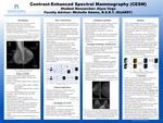 Contrast-Enhanced Spectral Mammography by Alyza Vega